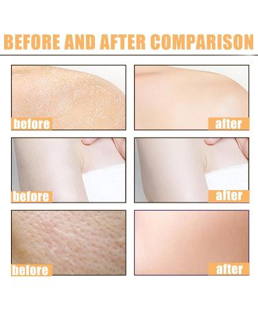 Face Scrub for Blackhead Yellow Sugar Face Scrub Exfoliator Reduce Acne & Improve Dull Skin 150ML Body Scrubs for Deak Skin Body Scrub Exfoliator Body Wash & Face Cleanser-Leg Exfoliator Body & Face - Buy Online on GoSupps.com