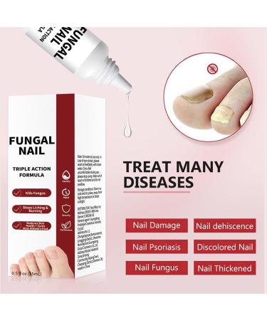 Nail Repair Liquid Damaged Hands and Feet Nails Repair Solution 15ml All Season Booster with Precise Dropper for Women Athletes Teens Adults Elderly - Buy Online on GoSupps.com