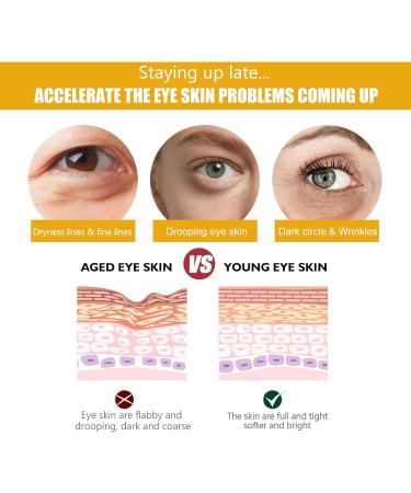  homomdy Set of 2 turmeric eye creams for dark circles under-eye bags anti-aging and moisturizing turmeric and vitamin C moisturizing eye cream - Reduces fine lines - Buy Online on GoSupps.com