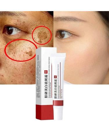 HOBIVA Freckle Whitening Cream Remove Dark Spots Melasma Lighten Skin Freckle Removal Cream for Face Acne Against Stubborn 20G/0.71Oz (Freckle Whitening) - Buy Online on GoSupps.com