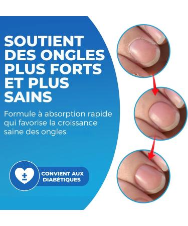 Imperial Feet Huile Pour Cuticules Pour La Croissance et Le Renforcement Des Ongles 30 Ml-Huile D'amande Jojoba et Vitamine e Pour Ongles et Cuticules-Hydrate Renforce Naturellement Les Ongles - Buy Online on GoSupps.com