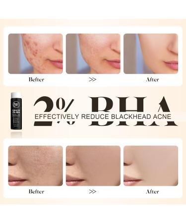 2% BHA Salicylic Acid Liquid Exfoliant Serum For Blackhead Removal Unclog Pores Smooths skin118mL 4 fl OZ Face Exfoliator For Facial Skin Care - Buy Online on GoSupps.com