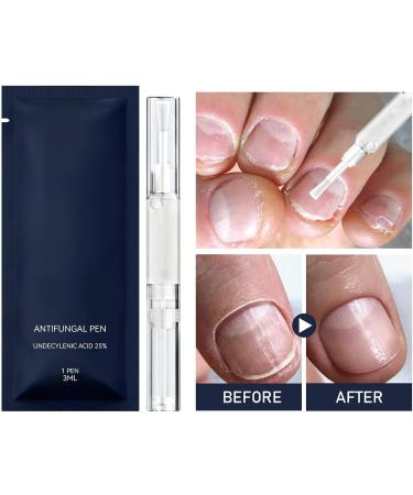 Stylo Pour Cuticules Renfor ant nourrissant 3 ml | Stylo pour Hydrater Renforcer et claircir les Ongles | pour Ongles des Pieds et des Mains Soin Quotidien Manucure Voyage Femmes Hommes - Buy Online on GoSupps.com