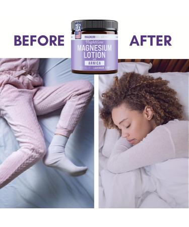 Magnum Solace Nighttime Magnesium Lotion with Arnica Soothing Relief & Relaxation Highly Concentrated Magnesium for Muscles & Joints Apply to Legs or Feet Before Bed Skin-Friendly - Buy Online on GoSupps.com
