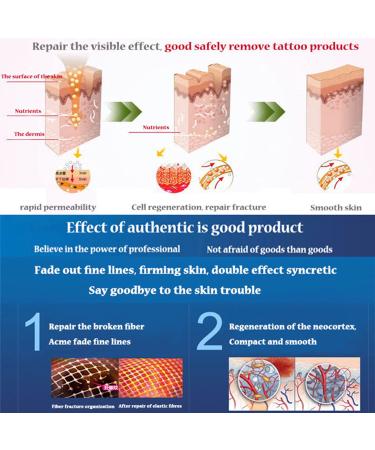 AICHUN BEAUTY Stretch Marks Cream with Snail Extract | Reduce Scars & Repair Damaged Skin | 120g - International Shipping Available - Buy Online on GoSupps.com