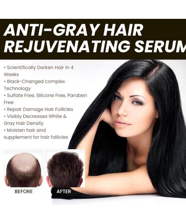  Miake Multiflorum-enriched anti-grey hair serum to naturally reverse grey regrowth for thicker healthier-looking hair 30 ml - Buy Online on GoSupps.com