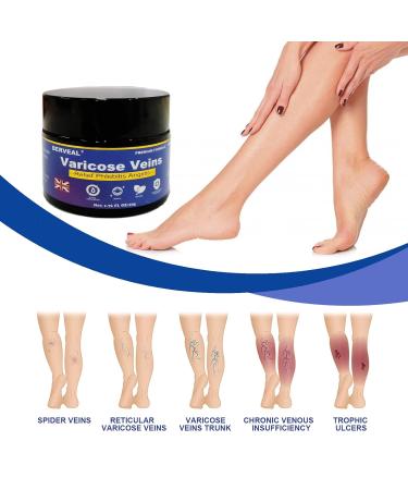 Varicose Veins Cream & Spider Veins Repair - Improve Blood Circulation & Soothe Itching - 1.76 OZ - Buy Online on GoSupps.com