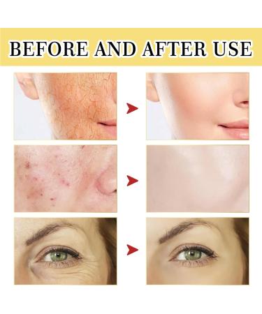 Snail Mucin Serum - Snail Mucin Essence - Hydrating Snail Mucin Moisturiser - Skin Repair Face Serum - Hyaluronic Acid Serum for Face - Dark Spot Correcting Glow Serum for Repair Dull and Damaged Skin - Buy Online on GoSupps.com