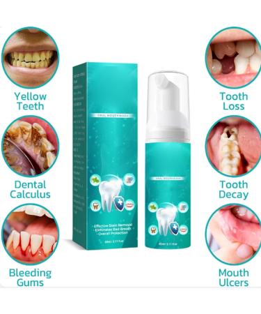 Herbal Brightening Oral Repair Foam & Gum Health Mouthwash - Teeth Whitening & Calculus Removal (2 Pcs) | International Shipping - Buy Online on GoSupps.com