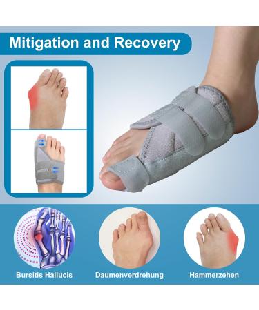 Hallux Valgus Correction Rail - Pain Relief & Toe Alignment for Men & Women | Right Gray - Buy Online on GoSupps.com