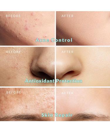 Organic Dead Sea Clay Mud Mask - Deep Pore Cleanser Antioxidant Skincare Soothes & Detoxifies - Ideal for All Skin Types - 2.8 oz - Buy Online on GoSupps.com