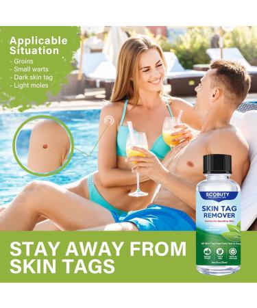 Skin Tag Removal Remover Kit Wart and Mole Remover Verruca Treatment for Hands Face Adults at Home 30ML - Buy Online on GoSupps.com