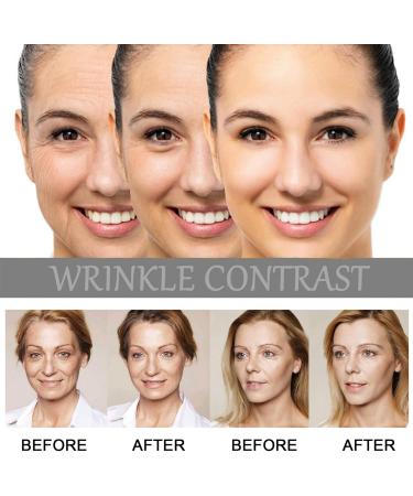 30ml Retinol 1% in Squalane Skincare Retinol Serum for Face Hyaluronic Acid Serum for Activate Skin High Strength for Face Reduce Fine Lines & Wrinkle Face Serum for Women Anti Aging Facial Serum - Buy Online on GoSupps.com