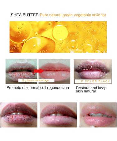 Lips Pink Bleaching Cream Balm Lip Lightening Scrub Balm Lip Lightening for Dark Lips Long Lasting Lip Care with Natural Oil Lip Care Lightens Remove Dark Lips for Women Moisturizing Lip Brightening - Buy Online on GoSupps.com