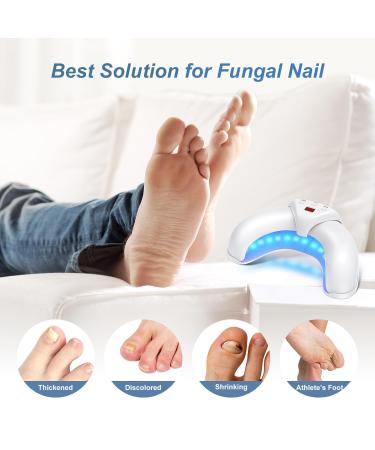 Buy Nail Fungus Light - 905nm Infrared & 470nm Blue Light for Safe Home Treatment - Effective Solution for Multiple Toenail Issues - Buy Online on GoSupps.com