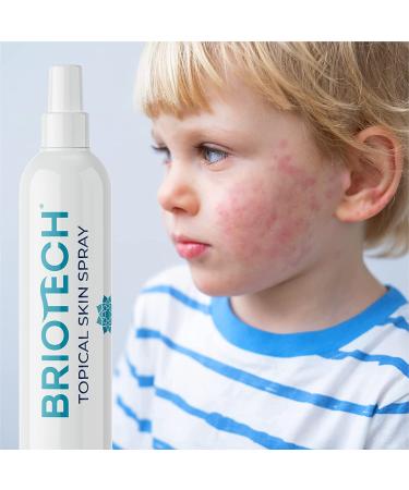 BRIOTECH Topical Skin Spray - Soothing HOCl Pure Hypochlorous for Face & Body - Support Irritations, Redness, Dry Skin, Athletic Itch - Natural Skincare - 128 Fl Oz - Buy Online on GoSupps.com