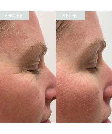 SKINICIAN Muli-Molecular Hyaluronic Elixir - Buy Online on GoSupps.com