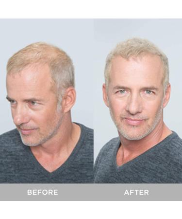 XFusion Keratin Hair Fibers - Light Brown | Instantly Conceals Thinning Hair - Buy Online on GoSupps.com