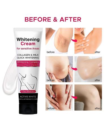 Natural and Mild Skin Lightening Cream for Face, Underarms, Neck, and Groin - Best for Dark Spots - Fast Results - Buy Online on GoSupps.com