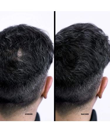 Super Million Hair Fibers - High-Quality Hair Thickening Loose Hair 15g Auburn (8) - Enhance Volume & Coverage for Thinning Hair - Buy Online on GoSupps.com