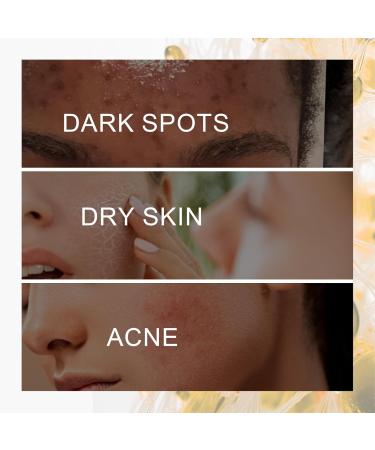 Niacinamide Spots Removal Serum Niacinamide Serum for Face Dark Spot Correcting Glow Serum Brightening Serum Dark Spot Remover for Face Serum Anti-Aging Acne Fine Line Hyperpigmentation - Buy Online on GoSupps.com