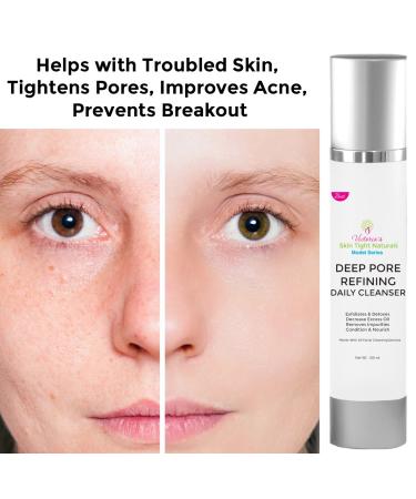 Victoria's Body Shoppe Deep Cleaning Pore Refining Face Cleanser - Anti-Aging Hydrating Formula | Celebrity Model Series - Shop Internationally - Buy Online on GoSupps.com