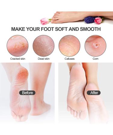 Pedicure Kit Professional 25 in 1 Foot Dead Skin Remover | Callus Remover Tools for Manicure & Foot Care | Gifts for Women Men - F04 - Buy Online on GoSupps.com