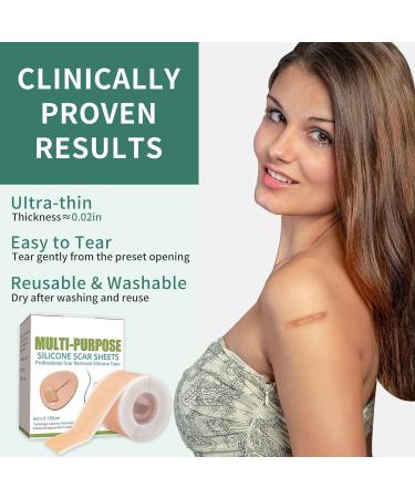 Medical Grade Silicone Scar Sheets (1.57 x 60) - Effective Scar Removal Strips for Acne & Burn Scars - Buy Online on GoSupps.com