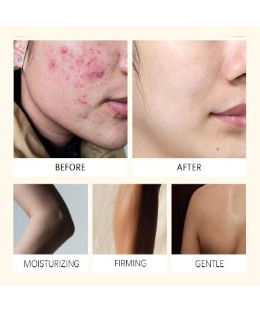  JASUBAI Turmeric Lemon Soap Illuminating Bar for Face and Body Even Complexion Dark Spot Removal Refreshing Exfoliating Bar Evens Complexion (6PCS) - Buy Online on GoSupps.com