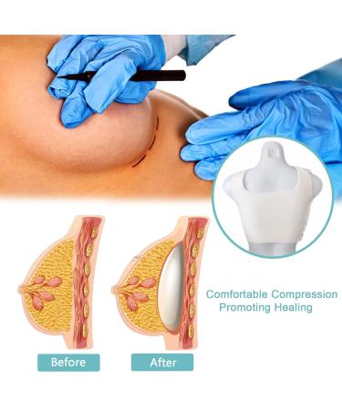 Fixed Belt for Breast Augmentation Recovery | Prevent Prosthesis Displacement (95 5cm) - International Shipping Available - Buy Online on GoSupps.com