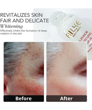 Skin Lightening And Glowing Face Cream Anti-Acne & Freckle Quickly Absorb Refreshing Non Greasy Smooth Texture Deep Moisturizing Skin Radiant 3 In 1 Set - Buy Online on GoSupps.com