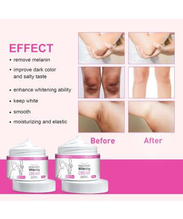 2025 1/2/3pcs 50ml Crema Para Manchas Oscuras En La Cara Pink Privates Intimate Area cream crema Para Las Manchas De La Cara Para Piel Entrepierna Manchas Codos Piernas Zonas Rodillas Cuello (1pcs) - Buy Online on GoSupps.com