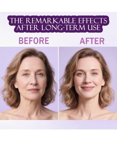 Calcium Multi Balm Calcium Volume Multi Balm Wrinkle Core Stick Collagen Moisturing Stick Anti-aging Hydrating Firming Skin Suitable for Eyes Neck Face 8g flesh color - Buy Online on GoSupps.com