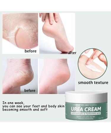 Urea Foot Cream 40% Cracked Heel Repair Cream Urea Cream For Cracked Heels and Dry Skin Foot Care Intensive Moisturizer Heel Balm For Cracked Heel Softens Feet & Hand & Knee Relieve Foot Pain-120g - Buy Online on GoSupps.com