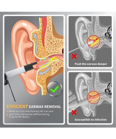 Electric Ear Wax Removal Kit with Camera and Light - Safe and Effective Ear Cleaner | 4 Pressure Settings | Complete Ear Cleaning Irrigation Kit for Adults and Kids - Buy Online on GoSupps.com
