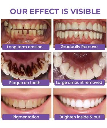 GFOUK Oral Crystal Cleansing Mousse - Tooth Mousse & Stain Removal Foam Purple Toothpaste for Whitening & Caries Prevention (2 Pieces) - Buy Online on GoSupps.com