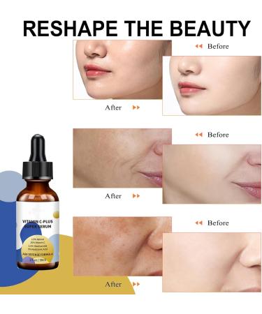 Super Dark Spot Correcting Glow Serum - Vitamin C Serum for Women - Anti-Aging Retinol Face Serum - Hyaluronic Acid Moisturizes Skin - Leave Skin Smooth 30ml - Buy Online on GoSupps.com
