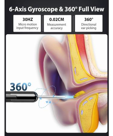 Qimic WiFi Ear Wax Removal Otoscope - 360 Waterproof Endoscope Camera with 6 LEDs for iPhone & Android - Buy Online on GoSupps.com