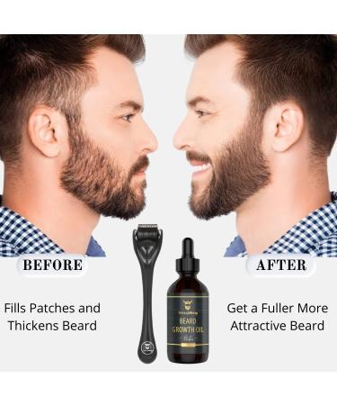 Striking Viking Beard Growth Kit: Beard Roller & Biotin Oil Set for Thickening and Conditioning Beards - Sandalwood Scented - Men's Facial Hair Growth Essentials - Buy Online on GoSupps.com