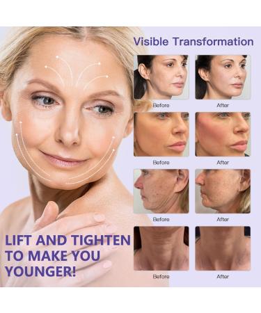  MITHCO Pack of 20 PDO fishbone wires for Cog lifting 18G100MM - Buy Online on GoSupps.com