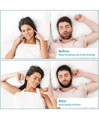 Snoring Chin Strap for Comfortable Sleep | Jaw Support Belt for Men & Women - Black | Nasal Breathing Mask - Buy Online on GoSupps.com