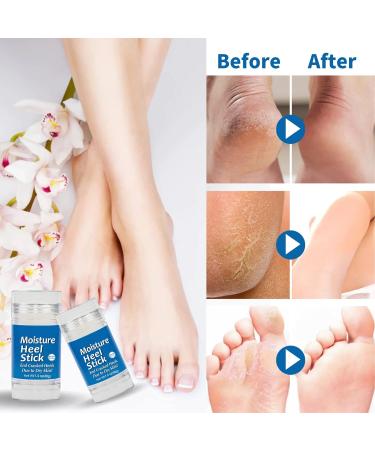 Cracked Heel Repair Stick for Dry Feet and Hands - Moisturizing Balm for Severe Cracks (2 Pack) - Buy Online on GoSupps.com