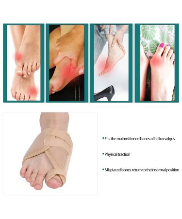 Hallux Valgus Corrector | Ergonomic Soft & Washable Toe Orthosis for Men & Women - Professional Great Toe Fixation - Buy Online on GoSupps.com