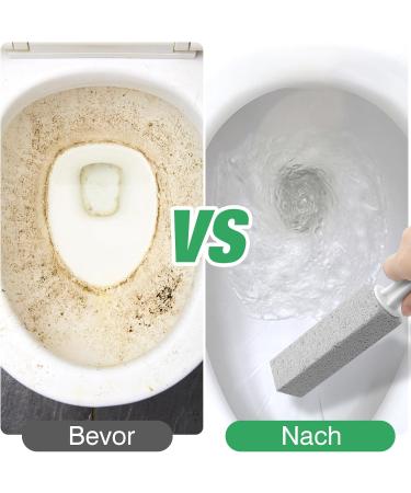 Vegcoo 5-Pack Pumice Stone Toilet Cleaner with Handle - Stubborn Stain & Limescale Remover for Home & Pool Use - Buy Online on GoSupps.com