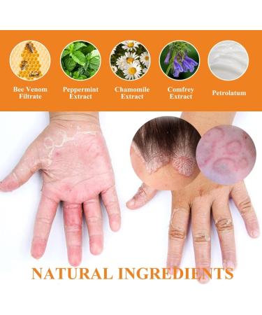 Bee Venom Psoriasis Treatment Cream - Soothing and Moisturizing Skin Relief - 3PCS - Buy Online on GoSupps.com