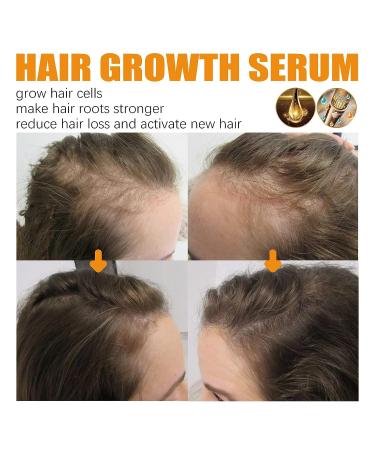 Nchampionba Allurium Hair Growth Serum with Chebe for Black Women - Revitalize Thinning Hair - 2pcs - Buy Online on GoSupps.com
