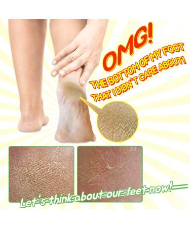 Elizavecca Witch Piggy Hell-Pore Turtle Foot Pack - Exfoliating & Moisturizing (1 Pair, 1.41 oz) - Buy Online on GoSupps.com