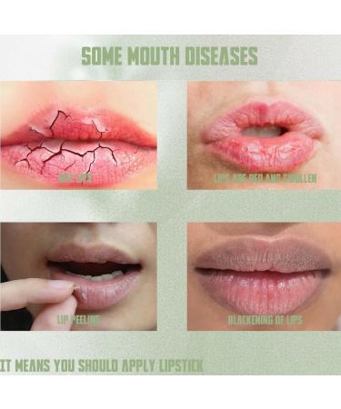 Lip Balm Lips Pink Bleaching Cream Balm Lip Lightening for Dark Lips Lip Care Lightens Remove Dark Lips Moisturizing Lip Balm Whitening & Brightening Lip Balm Stick for Women Scented Lip Balm - Buy Online on GoSupps.com
