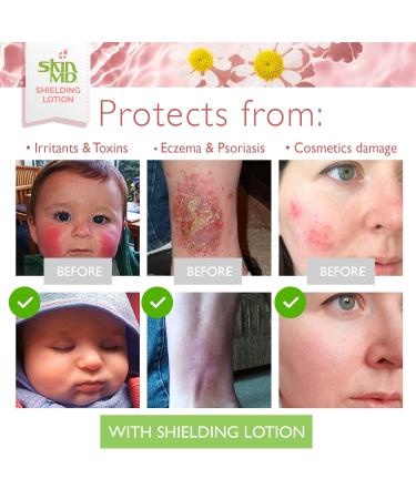 Buy Skin MD Natural Shielding Lotion | Eczema & Psoriasis Relief | 8 oz 3 Pack - All Skin Types - Buy Online on GoSupps.com