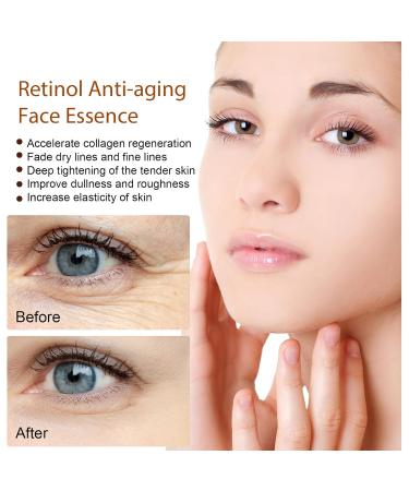 Retinol Facial Essence Gentle Moisturizing Replenishing Moisture Pore Minimizing Evening Skin Facial Serum 30ml - Buy Online on GoSupps.com